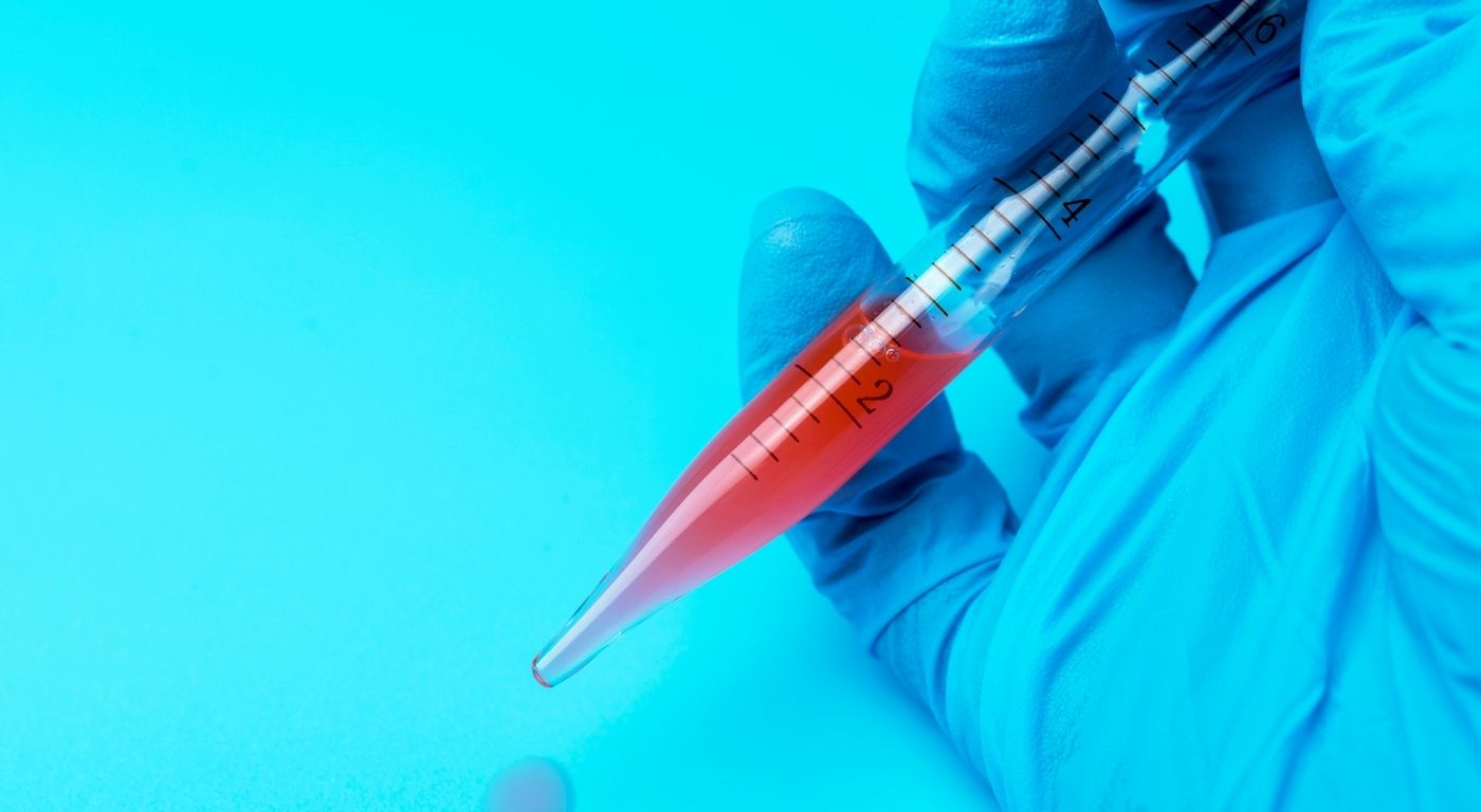 Allergen Testing